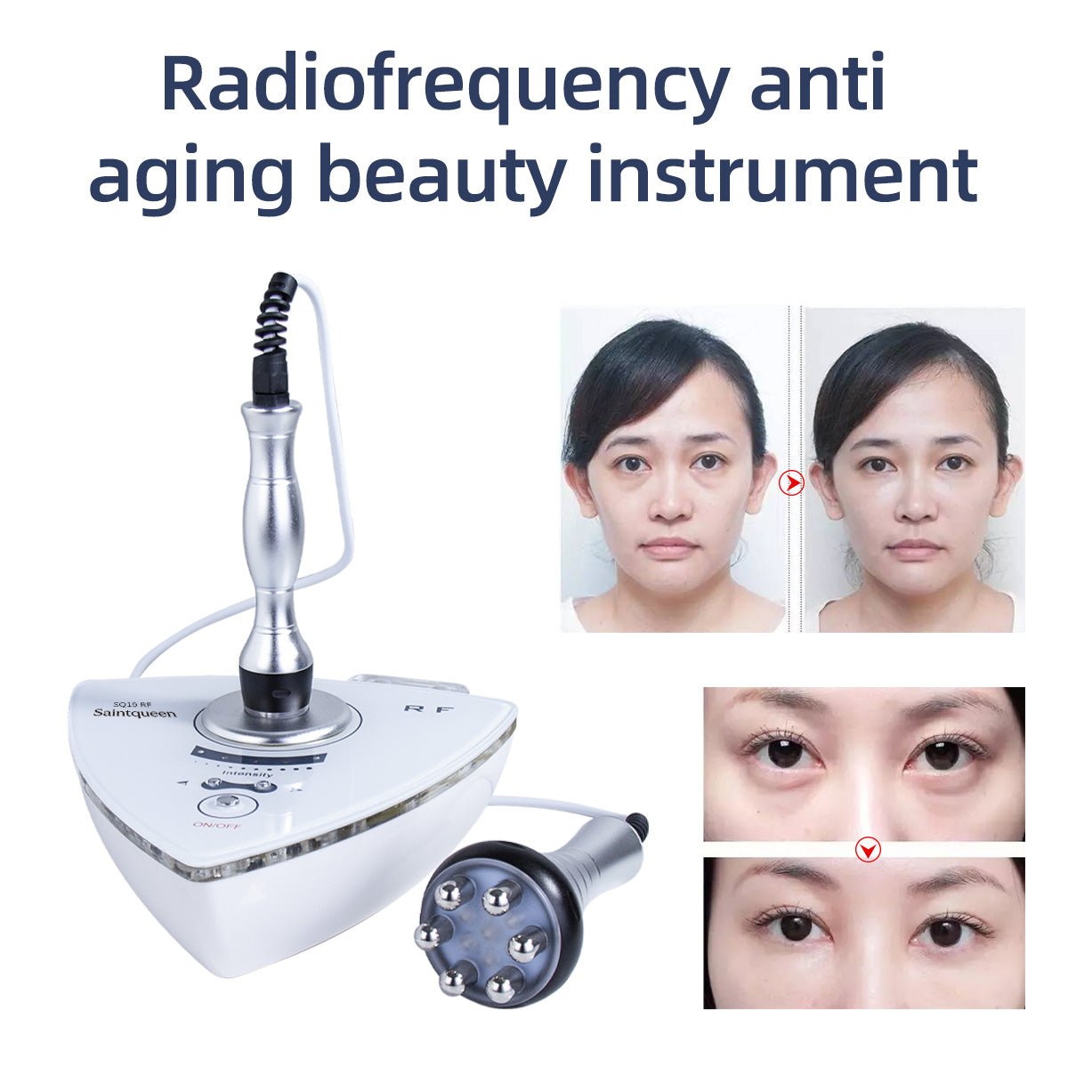 SQ19 — RF-аппарат для лица и тела с двумя манипулами и красным светом Второстепенное изображение товара
