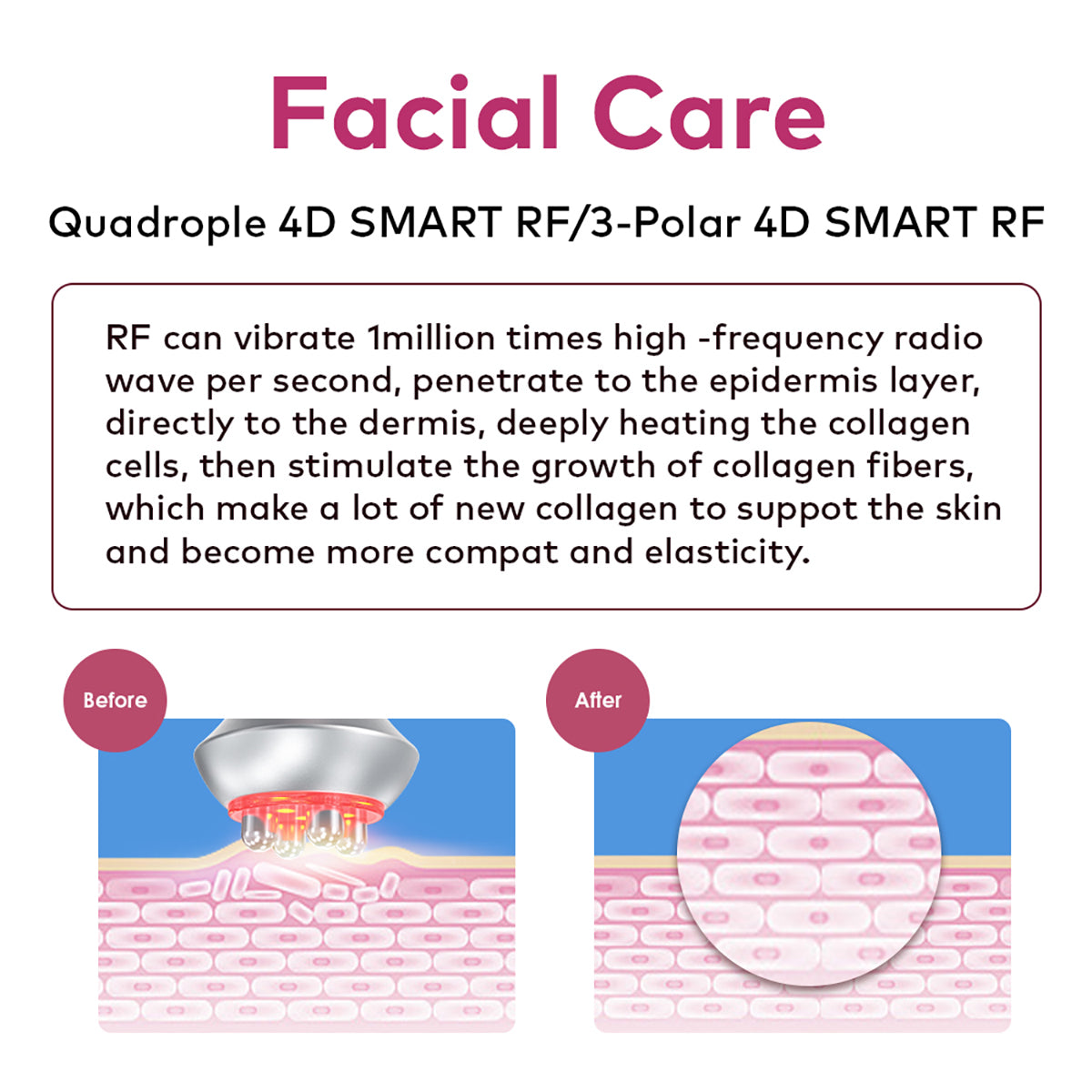 SQ90E Plus — аппарат кавитации 80K и RF, 9 в 1 с лазерными и микротоковыми панелями